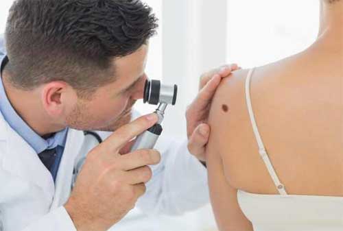 Apakah Kanker Kulit Melanoma Bisa Dicover BPJS Kesehatan 02 - Finansialku
